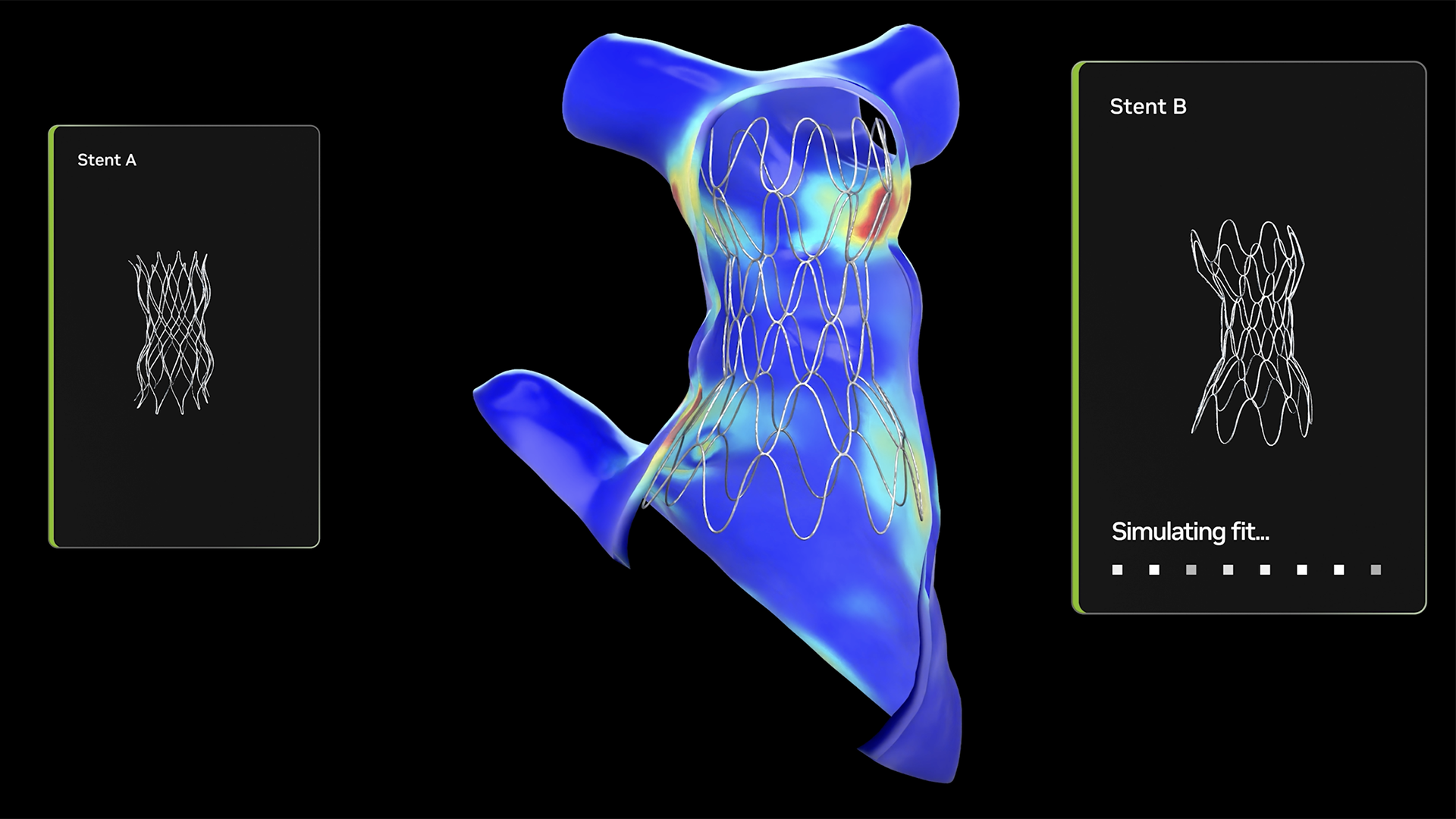NVIDIAが支援するCHOP、MONAIを活用し小児心臓モデルの生成時間を4時間から数秒へ短縮